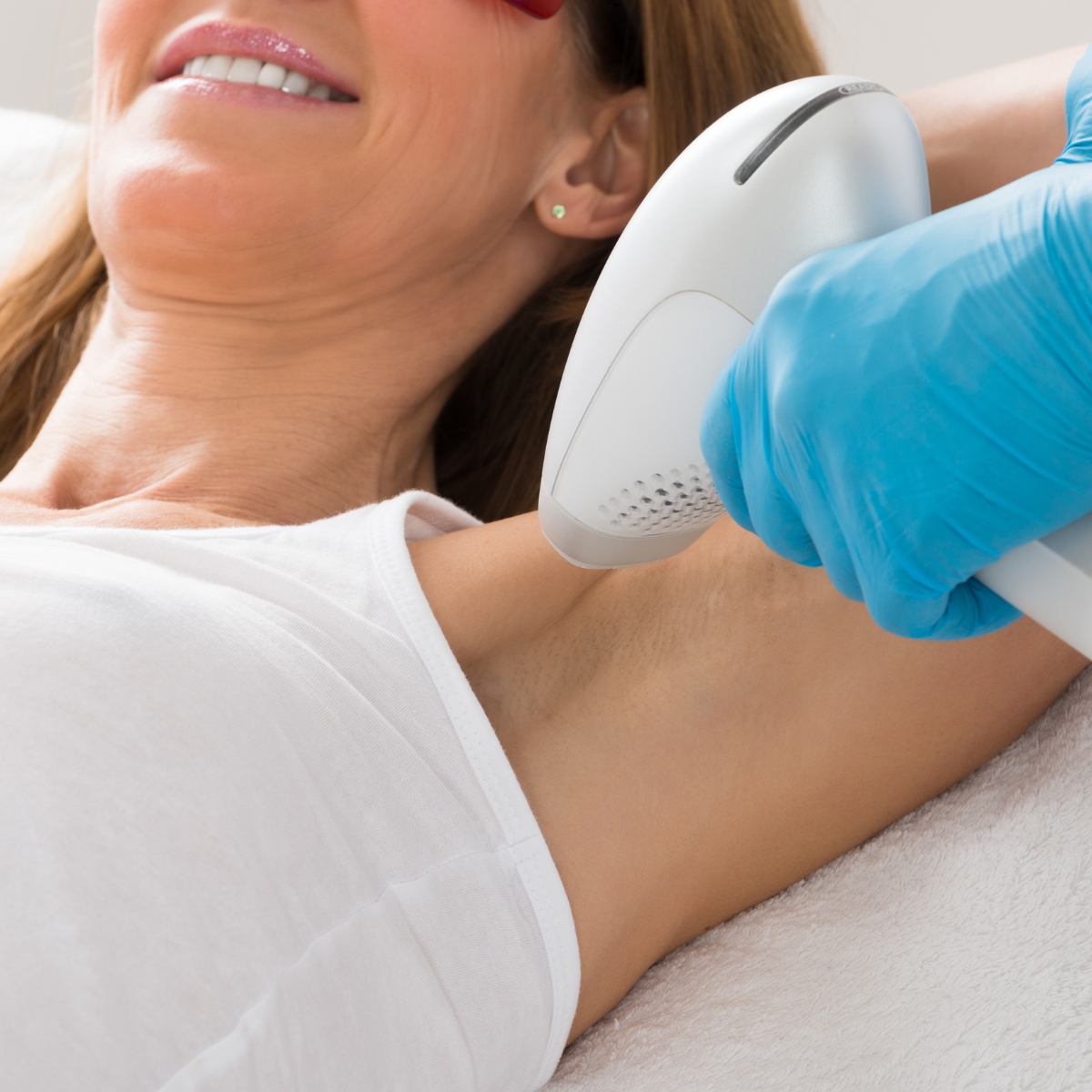 Depilazione laser